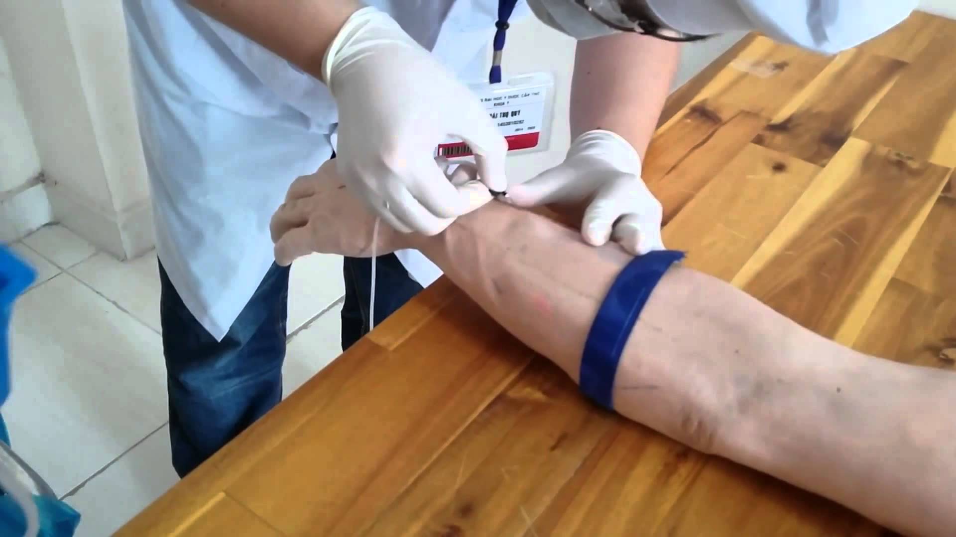 Lạm dụng thuốc tiêm tĩnh mạch (IVDA) - Hình ảnh minh họa